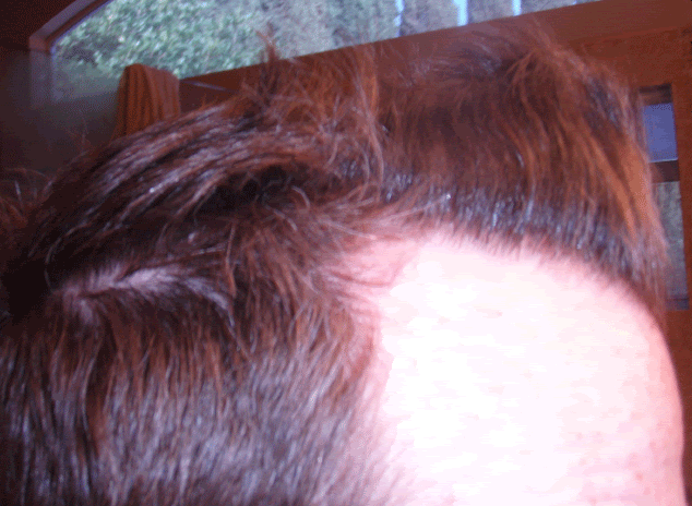 HT2_5mo_right_bedheadspike.gif