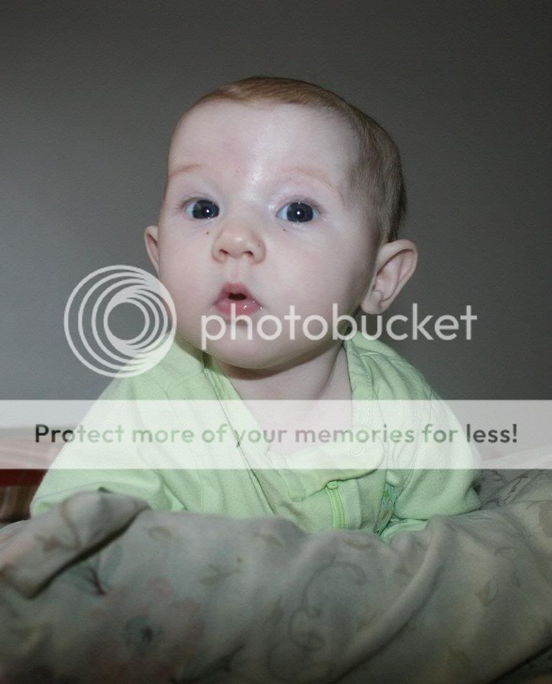 Baby's ears stick out Page 2 BabyCenter